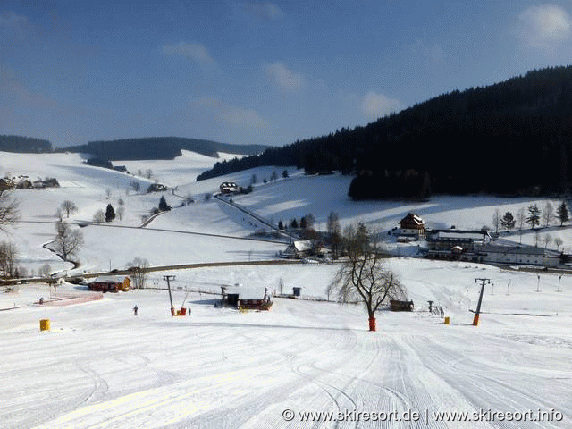 Schneeberglifte – Waldau (Titisee-Neustadt)